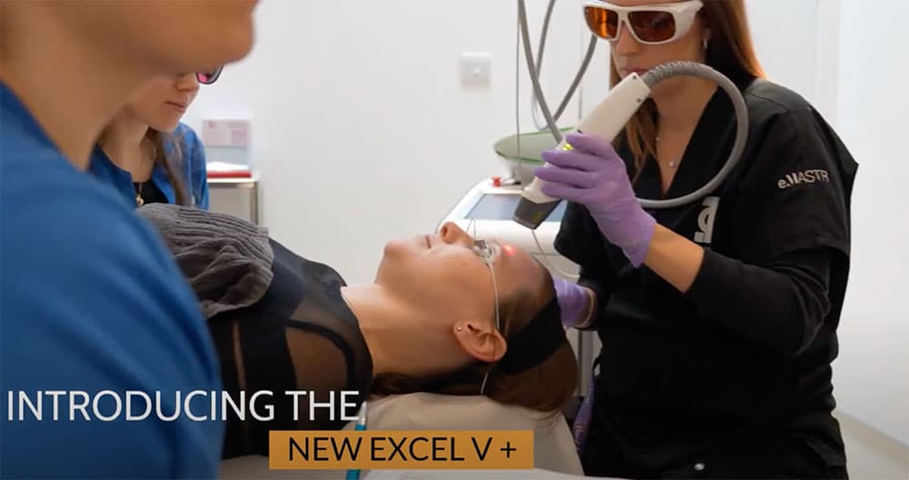 EXCEL V+  with the Genesis V applicator, PHI Clinic London