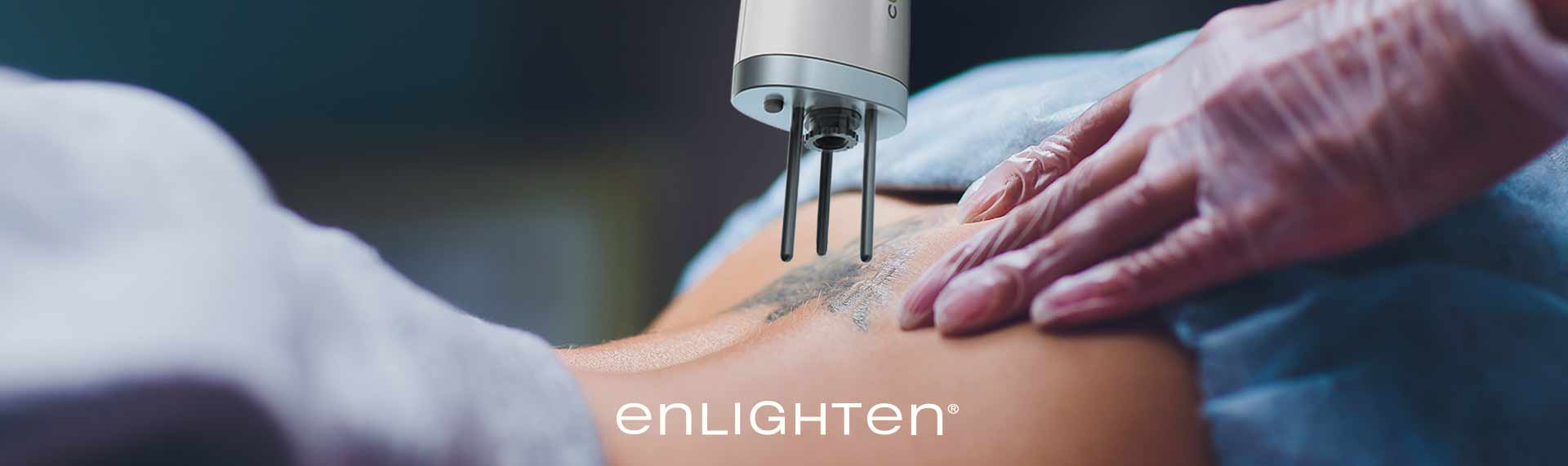 Laser tattoo removal  Enlighten tattoo removal  Harleh Laser Clinic  Pukekohe